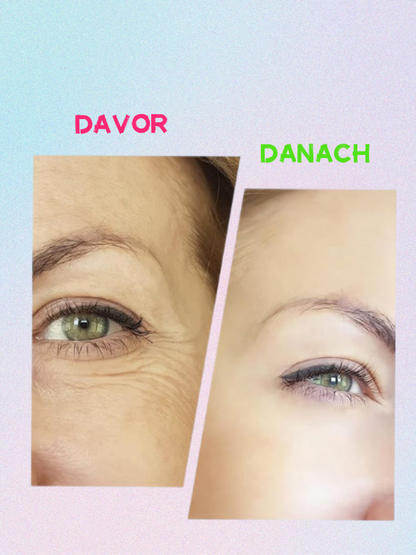 Madame-Glatt Glowlift